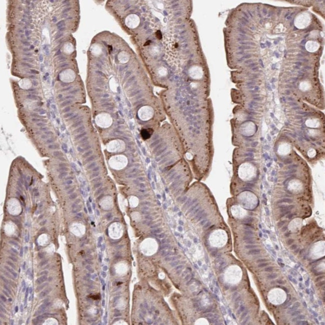 PRSS33 Antibody in Immunohistochemistry (Paraffin) (IHC (P))