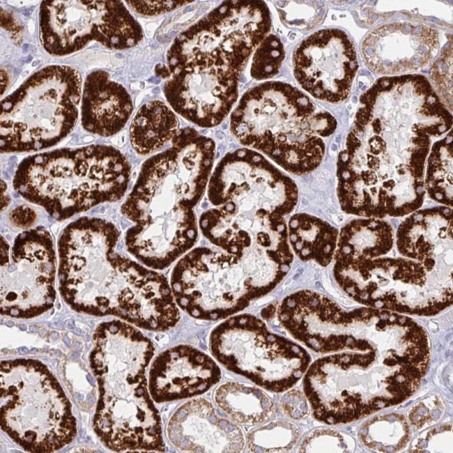 CHDH Antibody in Immunohistochemistry (Paraffin) (IHC (P))