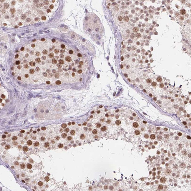 FAM53A Antibody in Immunohistochemistry (Paraffin) (IHC (P))