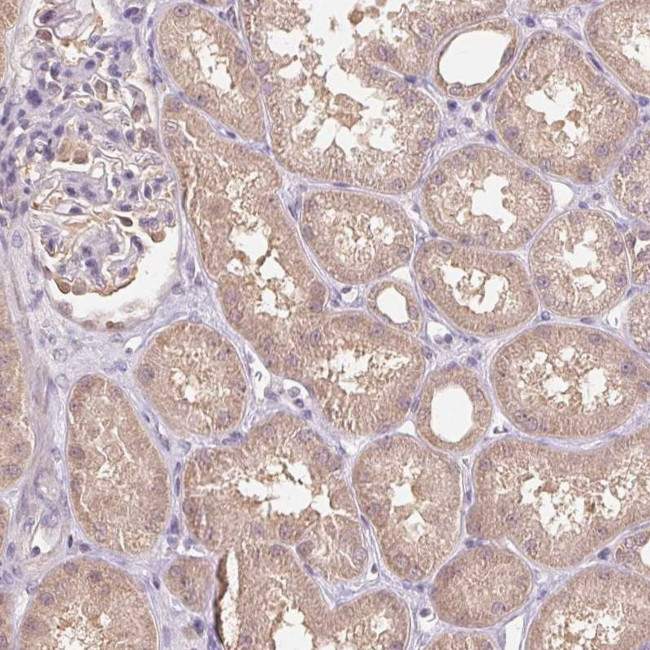 C10orf128 Antibody in Immunohistochemistry (Paraffin) (IHC (P))
