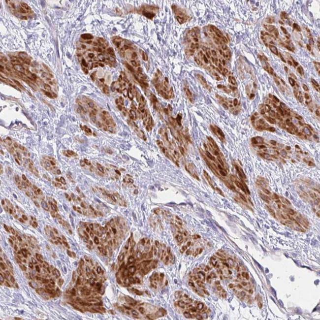 MOCS1 Antibody in Immunohistochemistry (Paraffin) (IHC (P))