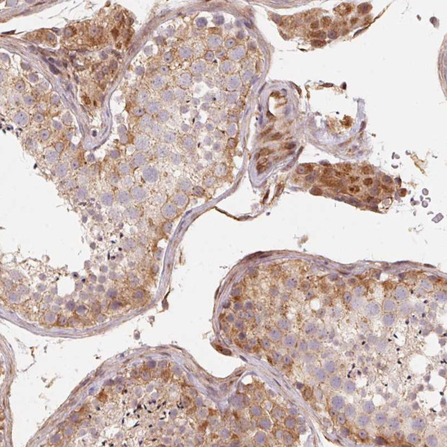 TSPAN12 Antibody in Immunohistochemistry (Paraffin) (IHC (P))