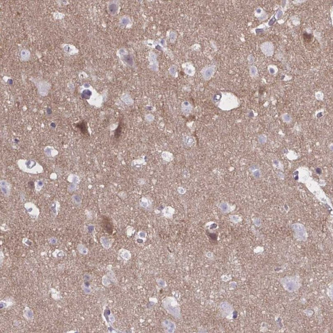NUMBL Antibody in Immunohistochemistry (IHC)