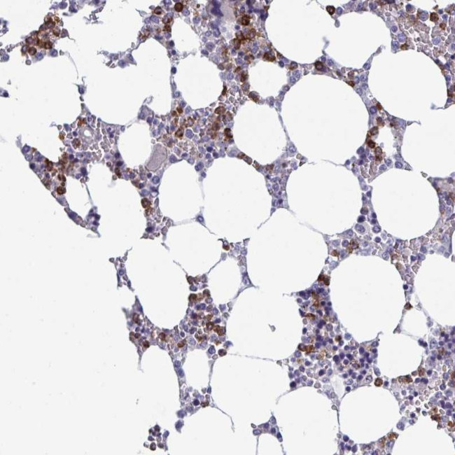 TXNRD3NB Antibody in Immunohistochemistry (Paraffin) (IHC (P))