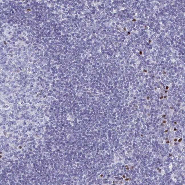 MCAR1 Antibody in Immunohistochemistry (IHC)