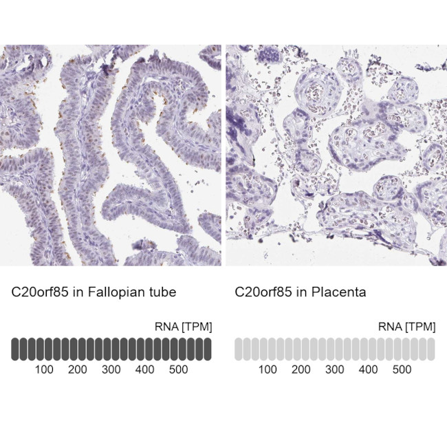 C20orf85 Antibody in Immunohistochemistry (IHC)