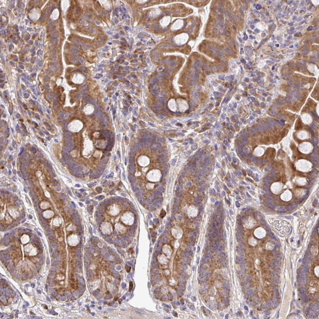 B4GALT6 Antibody in Immunohistochemistry (Paraffin) (IHC (P))