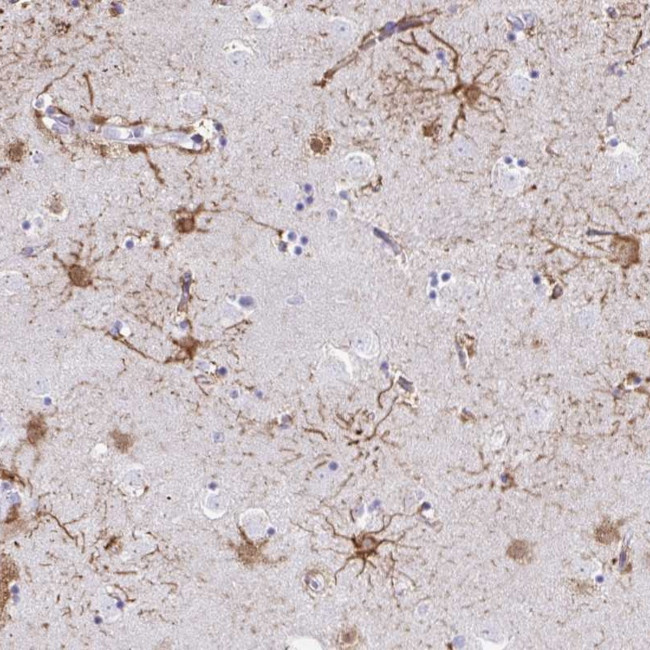 ZNF699 Antibody in Immunohistochemistry (Paraffin) (IHC (P))