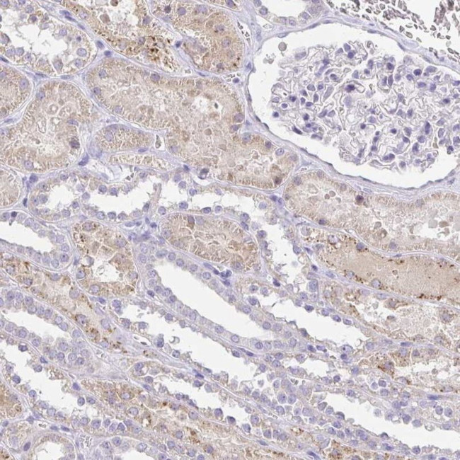 PKN3 Antibody in Immunohistochemistry (IHC)