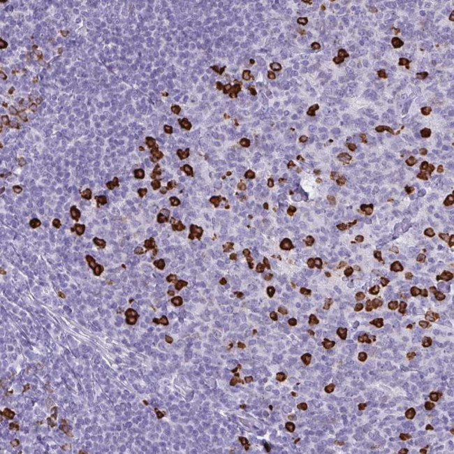 CDADC1 Antibody in Immunohistochemistry (Paraffin) (IHC (P))