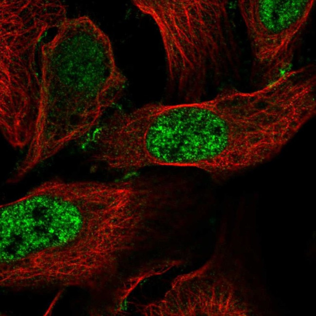 CCDC85C Antibody in Immunocytochemistry (ICC/IF)