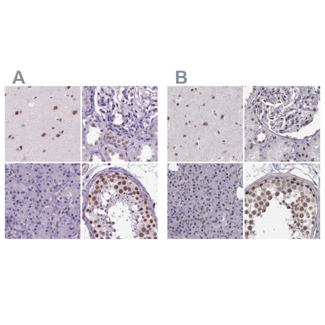 SETD1A Antibody in Immunohistochemistry (IHC)