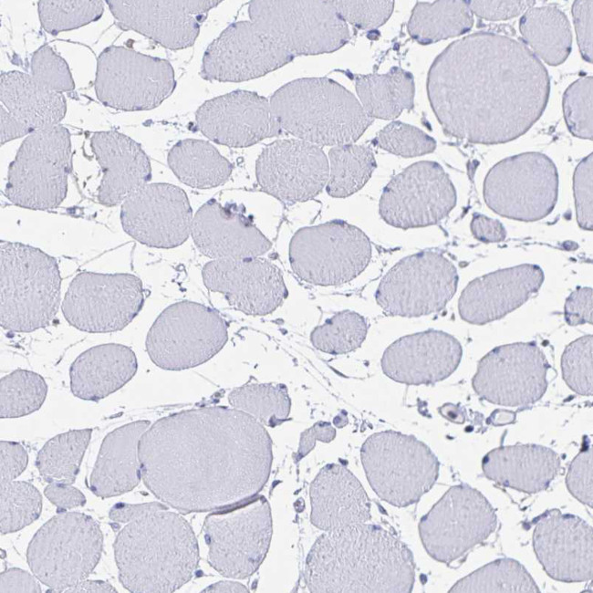 SNTN Antibody in Immunohistochemistry (Paraffin) (IHC (P))