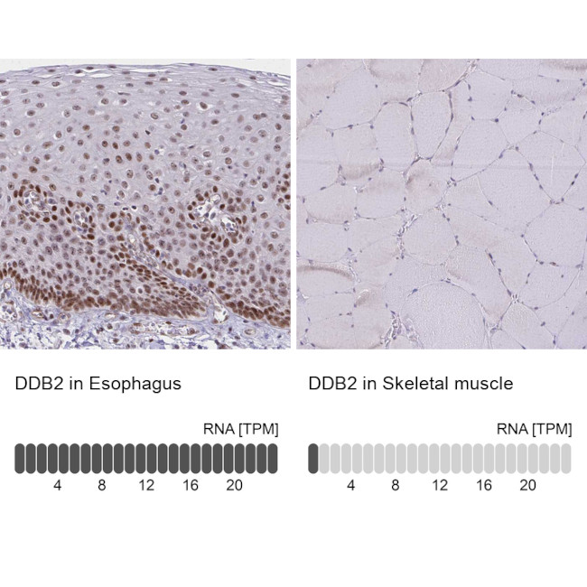 DDB2 Antibody in Immunohistochemistry (IHC)