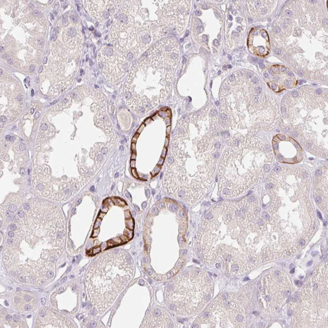 FXYD4 Antibody in Immunohistochemistry (Paraffin) (IHC (P))