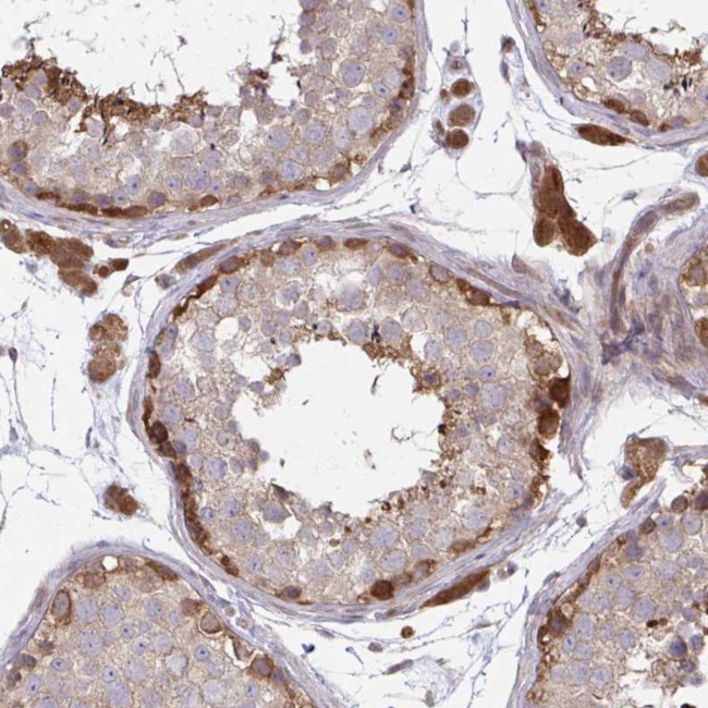 LMNTD2 Antibody in Immunohistochemistry (Paraffin) (IHC (P))