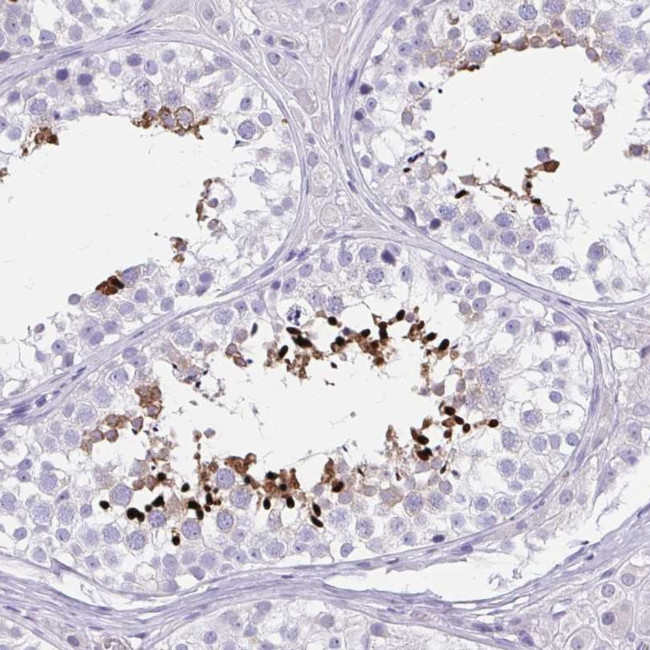 LRRC36 Antibody in Immunohistochemistry (Paraffin) (IHC (P))