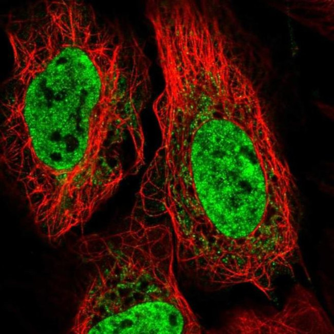 TNNC2 Antibody in Immunocytochemistry (ICC/IF)