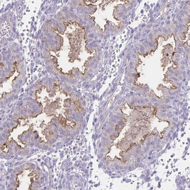 SEMA6B Antibody in Immunohistochemistry (Paraffin) (IHC (P))