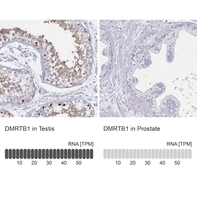 DMRTB1 Antibody in Immunohistochemistry (IHC)