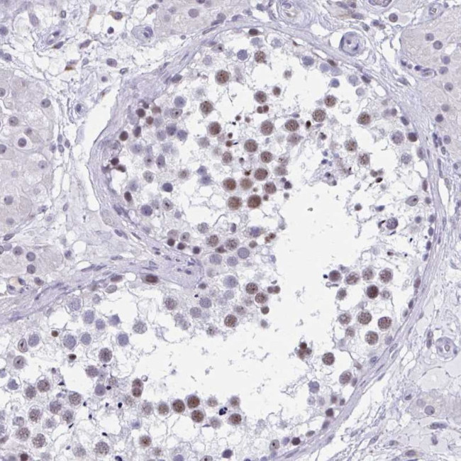CCDC105 Antibody in Immunohistochemistry (Paraffin) (IHC (P))