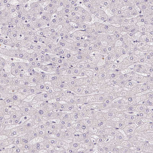 Smoothelin Antibody in Immunohistochemistry (Paraffin) (IHC (P))