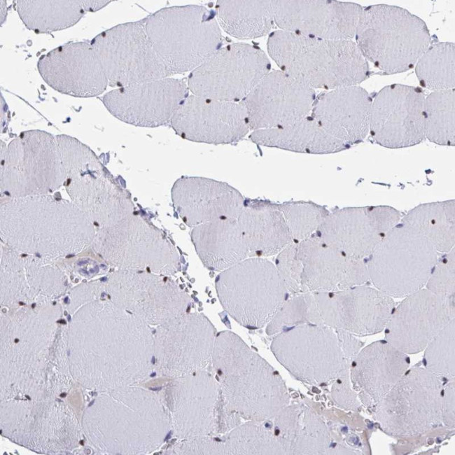 USP35 Antibody in Immunohistochemistry (Paraffin) (IHC (P))
