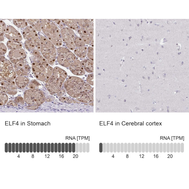 ELF4 Antibody in Immunohistochemistry (IHC)