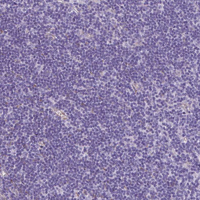 NGB Antibody in Immunohistochemistry (Paraffin) (IHC (P))