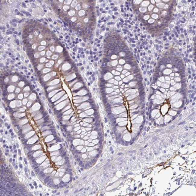 PIGZ Antibody in Immunohistochemistry (Paraffin) (IHC (P))