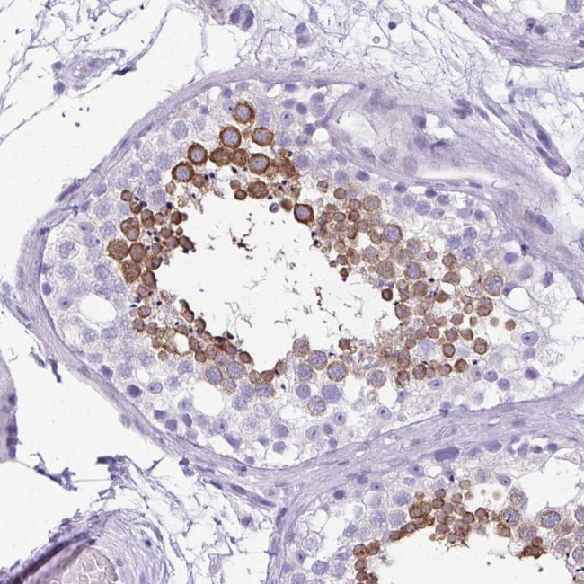 CLGN Antibody in Immunohistochemistry (Paraffin) (IHC (P))