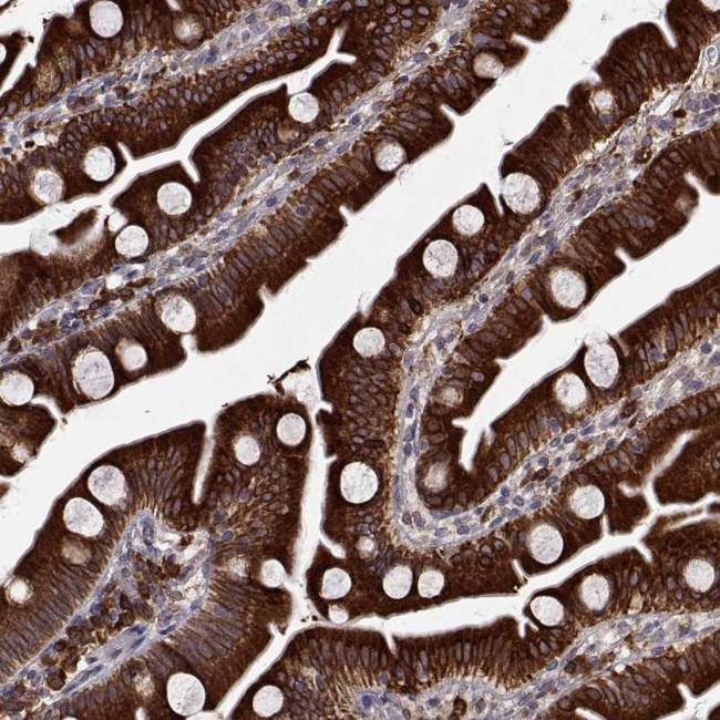 PGRMC2 Antibody in Immunohistochemistry (Paraffin) (IHC (P))