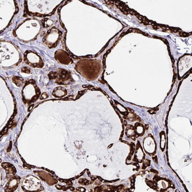 ORP5 Antibody in Immunohistochemistry (Paraffin) (IHC (P))