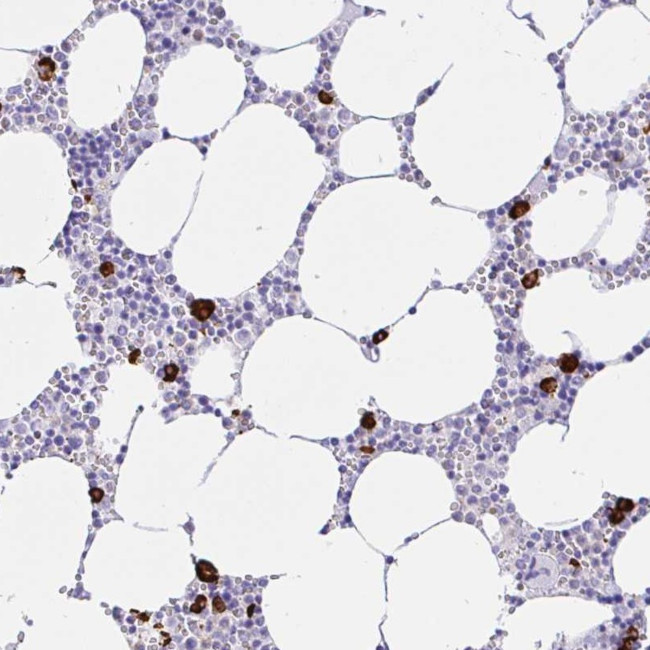CCDC62 Antibody in Immunohistochemistry (Paraffin) (IHC (P))