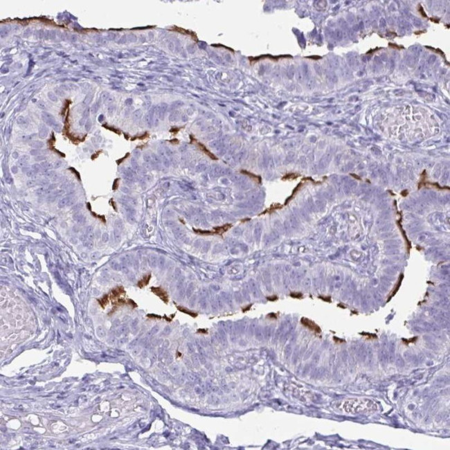 BBS10 Antibody in Immunohistochemistry (IHC)