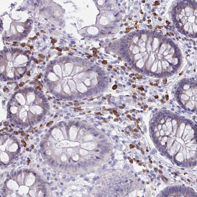 PUS7L Antibody in Immunohistochemistry (IHC)