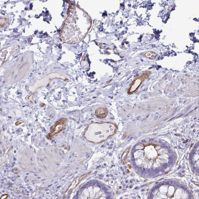 UBL3 Antibody in Immunohistochemistry (Paraffin) (IHC (P))