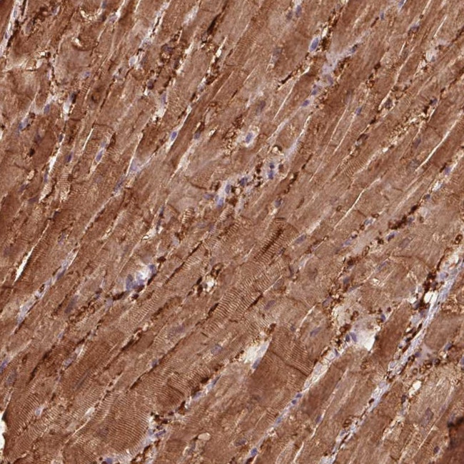 CCDC168 Antibody in Immunohistochemistry (Paraffin) (IHC (P))