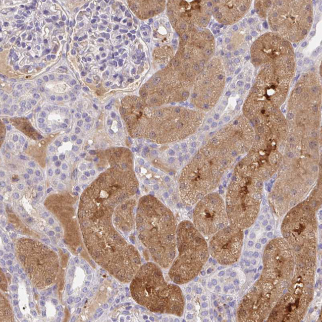ANO5 Antibody in Immunohistochemistry (Paraffin) (IHC (P))