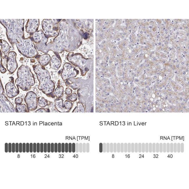 STARD13 Antibody in Immunohistochemistry (IHC)