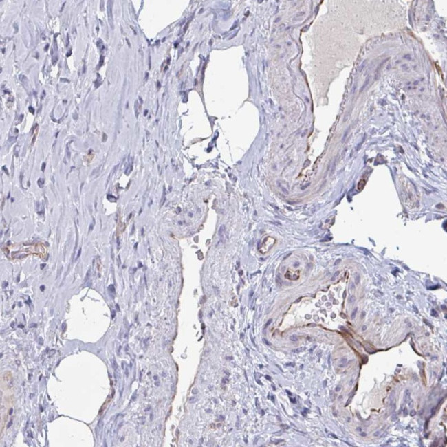 OR1L3 Antibody in Immunohistochemistry (Paraffin) (IHC (P))