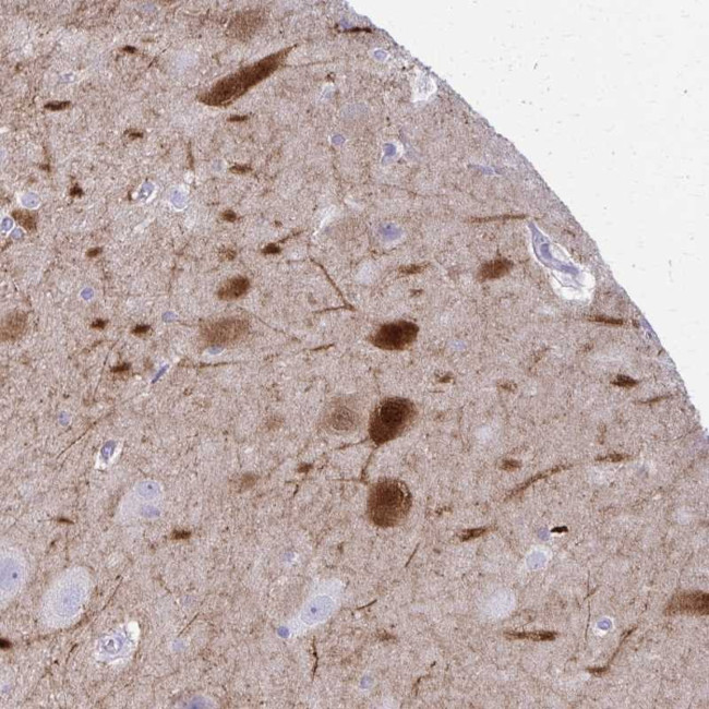 OR4M2 Antibody in Immunohistochemistry (Paraffin) (IHC (P))
