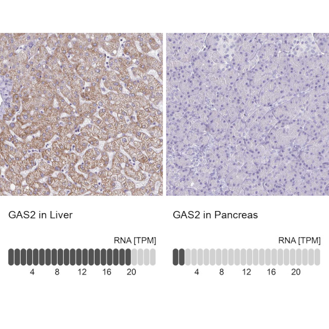 GAS2 Antibody in Immunohistochemistry (IHC)