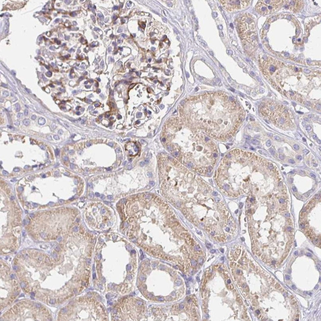 PALM2-AKAP2 Antibody in Immunohistochemistry (Paraffin) (IHC (P))