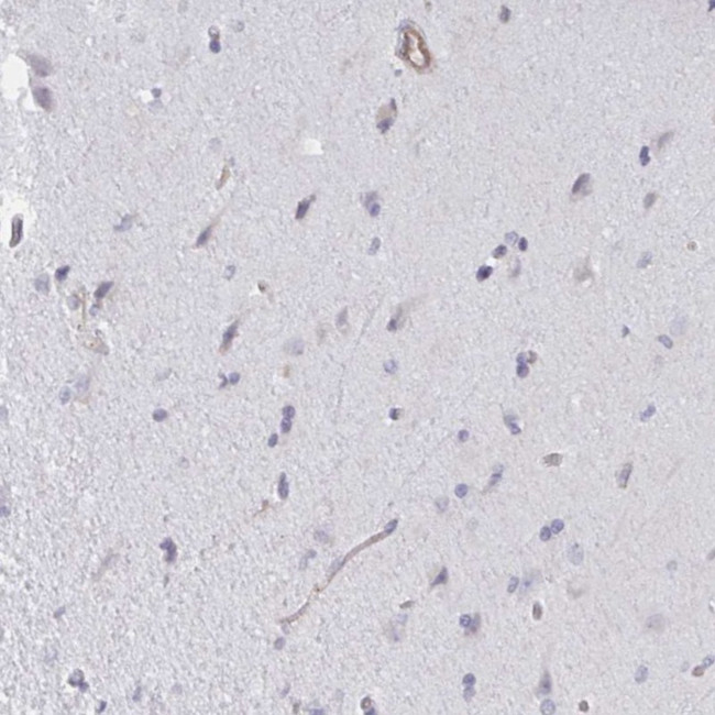 SHISA7 Antibody in Immunohistochemistry (Paraffin) (IHC (P))