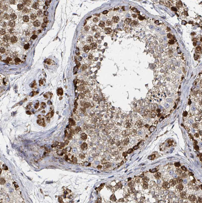 ATAD3B Antibody in Immunohistochemistry (Paraffin) (IHC (P))