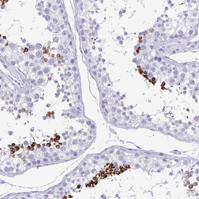 TCEAL3 Antibody in Immunohistochemistry (Paraffin) (IHC (P))
