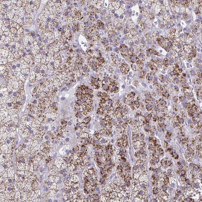 LRRC4B Antibody in Immunohistochemistry (Paraffin) (IHC (P))