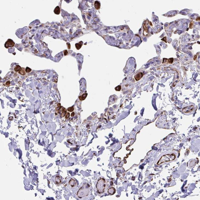 CACNG3 Antibody in Immunohistochemistry (Paraffin) (IHC (P))