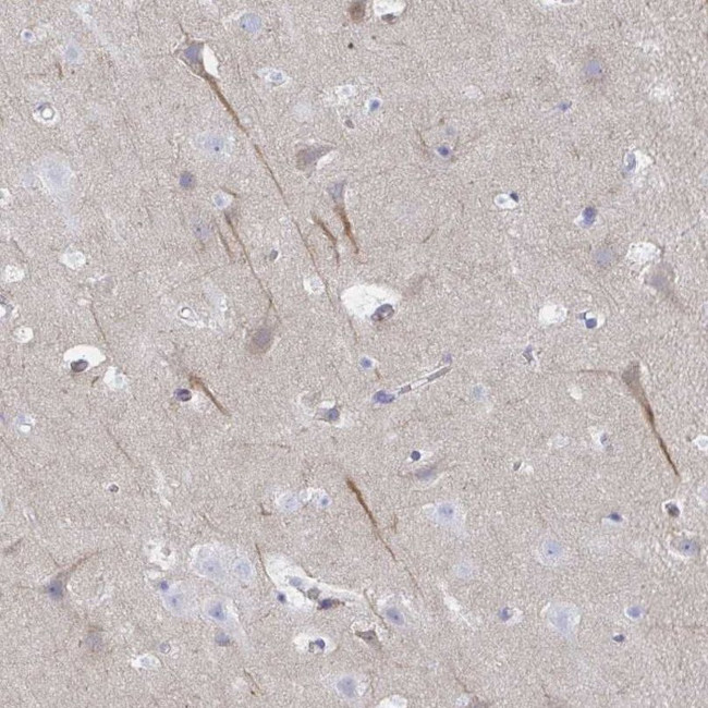 CEP170B Antibody in Immunohistochemistry (IHC)
